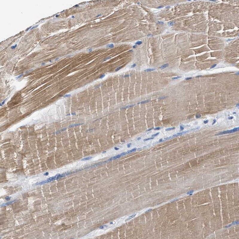 Myosin Heavy Chain 3 Antibody - BSA Free Immunohistochemistry-Paraffin: Myosin Heavy Chain 3 Antibody - BSA Free [NBP1-89707]