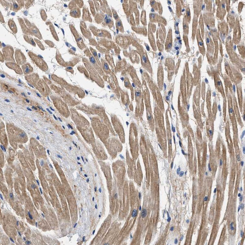 Myosin Heavy Chain 3 Antibody - BSA Free Immunohistochemistry-Paraffin: Myosin Heavy Chain 3 Antibody - BSA Free [NBP1-89707]