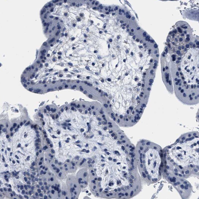 Myosin Heavy Chain 3 Antibody - BSA Free Immunohistochemistry-Paraffin: Myosin Heavy Chain 3 Antibody - BSA Free [NBP1-89707]