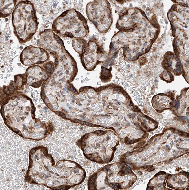 ATPase Antibody - BSA Free Immunohistochemistry-Paraffin: ATPase Antibody - BSA Free [NBP1-89709]