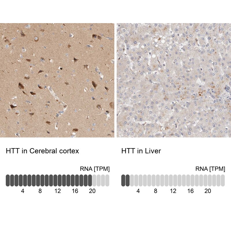 Huntingtin Antibody - BSA Free Immunohistochemistry-Paraffin: Huntingtin Antibody - BSA Free [NBP1-89710]