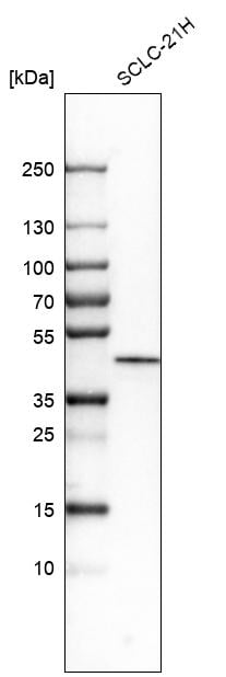 Casein Kinase 1 epsilon Antibody - BSA Free Western Blot: Casein Kinase 1 epsilon Antibody - BSA Free [NBP1-89712]