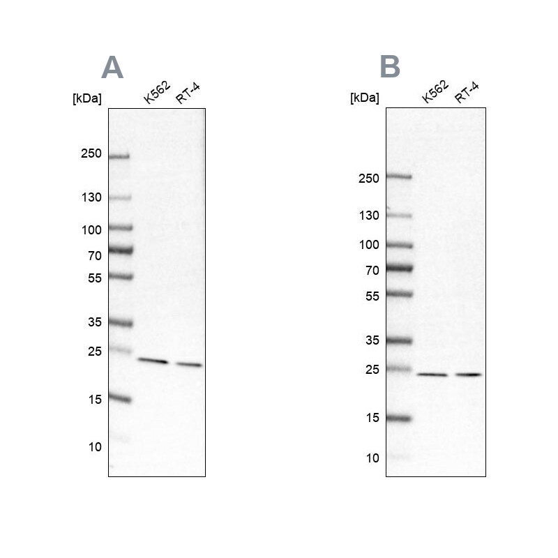 Proteasome beta 1 Antibody - BSA Free Western Blot: Proteasome beta 1 Antibody - BSA Free [NBP1-89713]