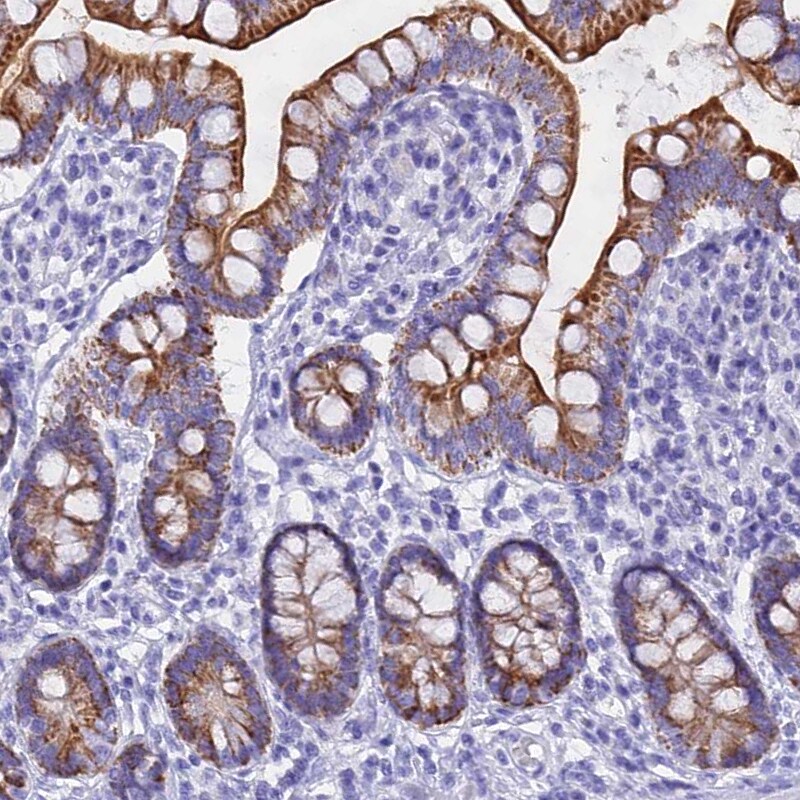 HBLD2 Antibody - BSA Free Immunohistochemistry-Paraffin: HBLD2 Antibody - BSA Free [NBP1-89715]