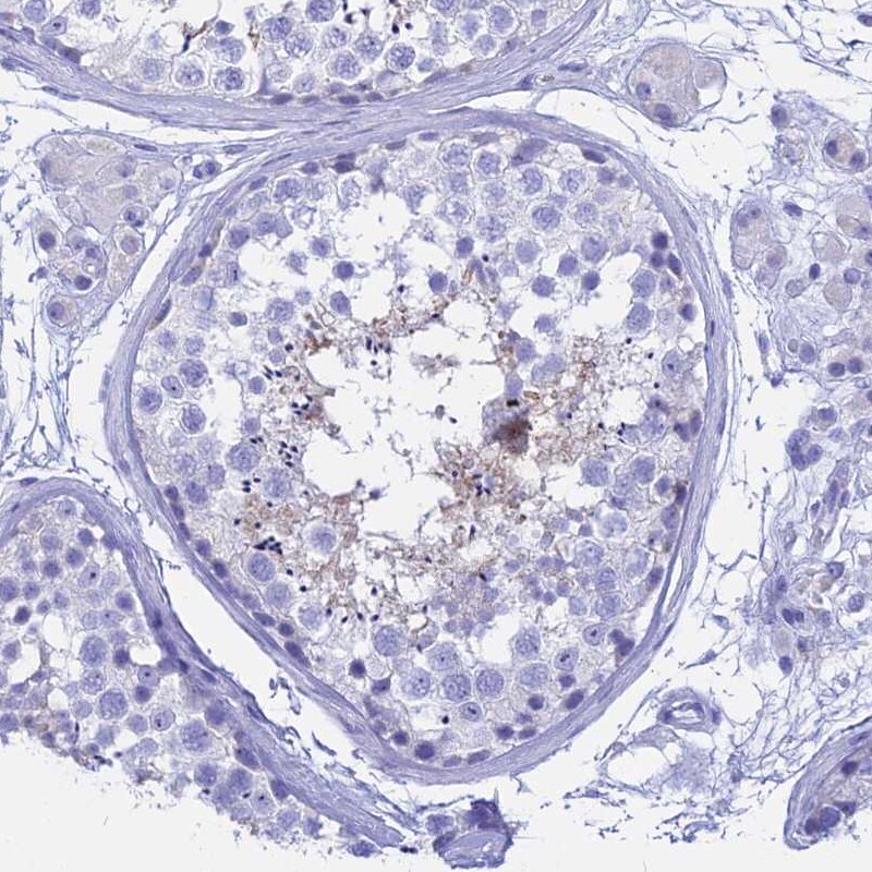 HBLD2 Antibody - BSA Free Immunohistochemistry-Paraffin: HBLD2 Antibody - BSA Free [NBP1-89715]