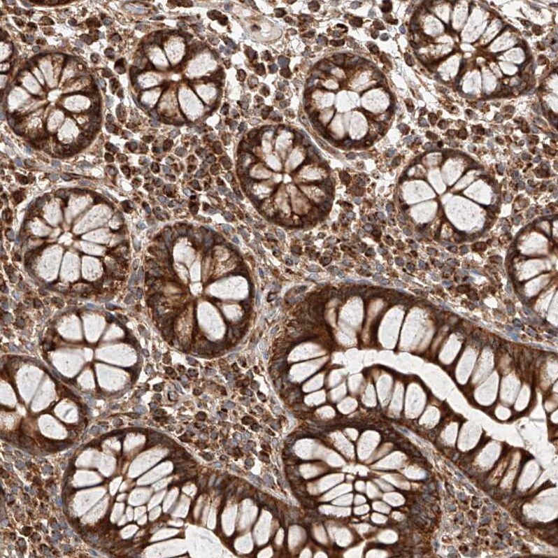 HBLD1 Antibody - BSA Free Immunohistochemistry-Paraffin: HBLD1 Antibody - BSA Free [NBP1-89716]