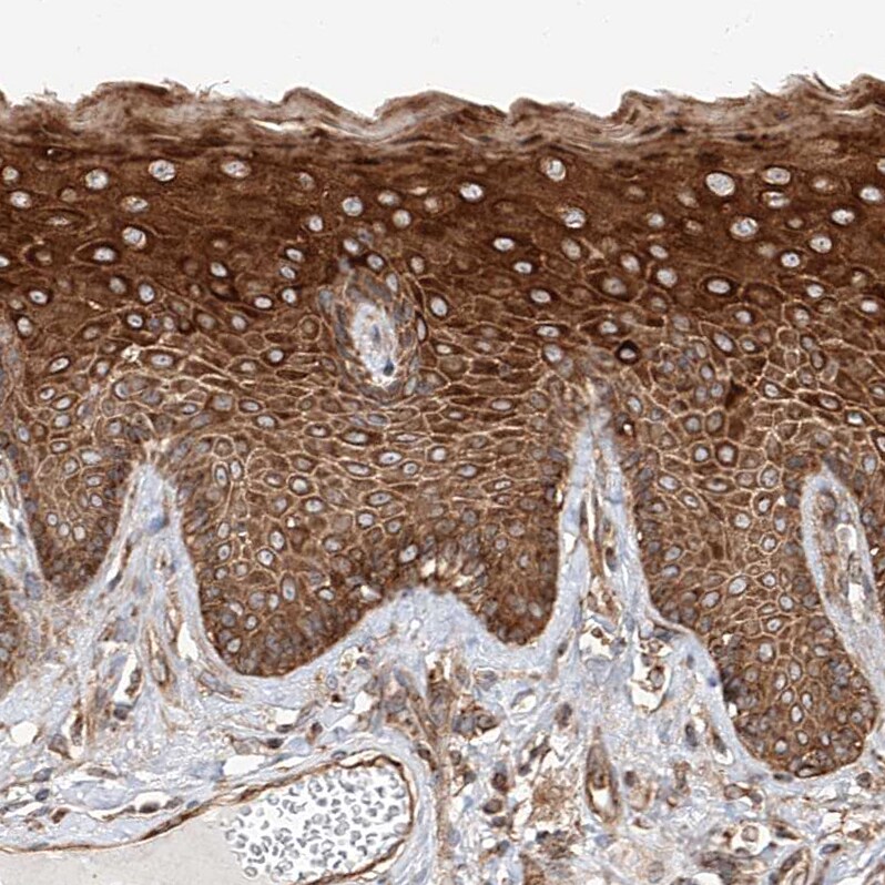 HBLD1 Antibody - BSA Free Immunohistochemistry-Paraffin: HBLD1 Antibody - BSA Free [NBP1-89716]