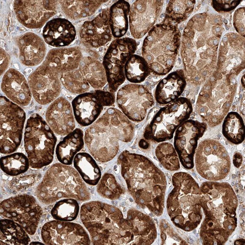 HBLD1 Antibody - BSA Free Immunohistochemistry-Paraffin: HBLD1 Antibody - BSA Free [NBP1-89716]