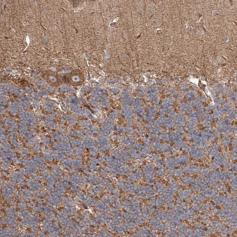 HBLD1 Antibody - BSA Free Immunohistochemistry-Paraffin: HBLD1 Antibody - BSA Free [NBP1-89716]