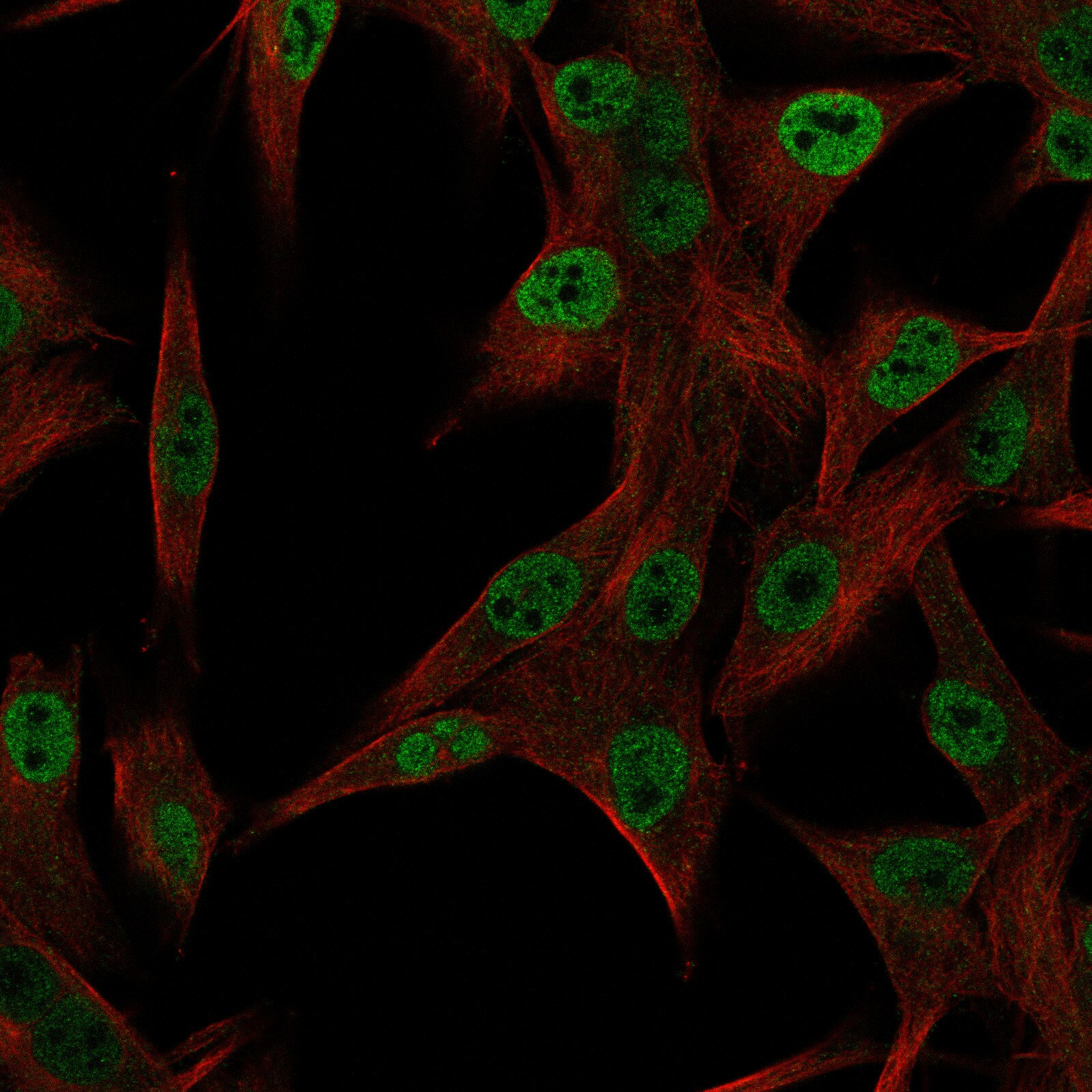 HLX1 Antibody - BSA Free Immunocytochemistry/ Immunofluorescence - HLX1 Antibody [NBP1-89719]