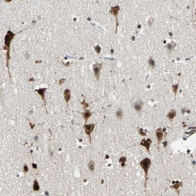 HLX1 Antibody - BSA Free Immunohistochemistry - HLX1 Antibody [NBP1-89719]