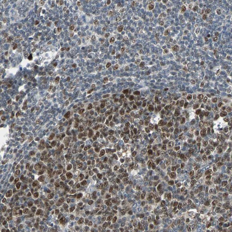 HLX1 Antibody - BSA Free Immunohistochemistry-Paraffin: HLX1 Antibody - BSA Free [NBP1-89719]