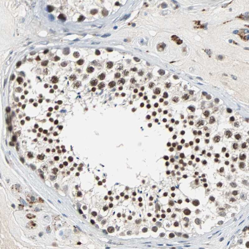 HLX1 Antibody - BSA Free Immunohistochemistry-Paraffin: HLX1 Antibody - BSA Free [NBP1-89719]