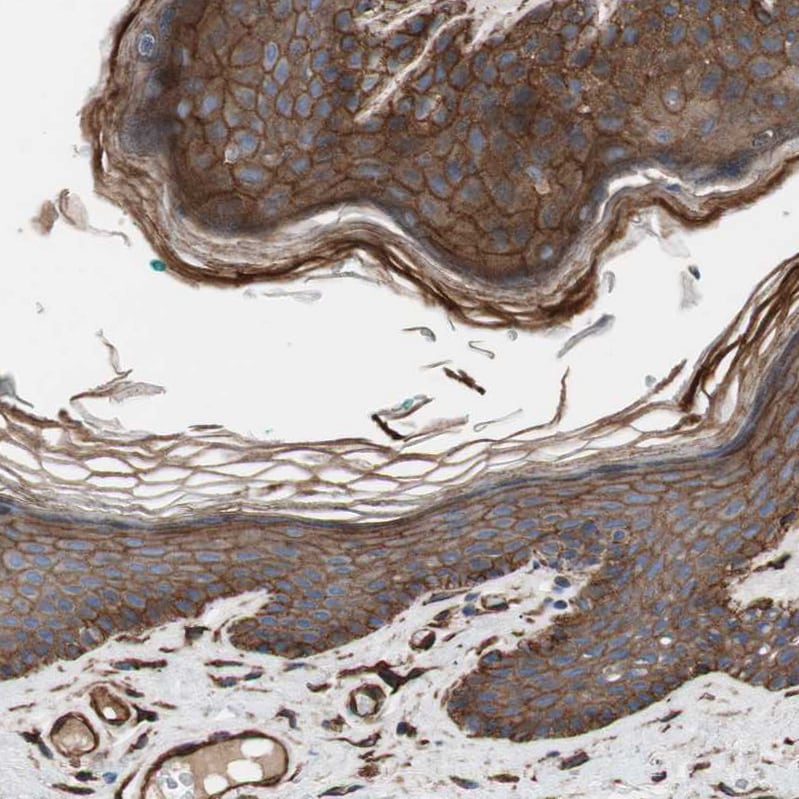 HAI-1/HGFA Inhibitor 1 Antibody - BSA Free Immunohistochemistry-Paraffin: HAI-1/HGFA Inhibitor 1 Antibody - BSA Free [NBP1-89720]