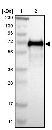 HAI-1/HGFA Inhibitor 1 Antibody - BSA Free Western Blot: HAI-1/HGFA Inhibitor 1 Antibody - BSA Free [NBP1-89720]