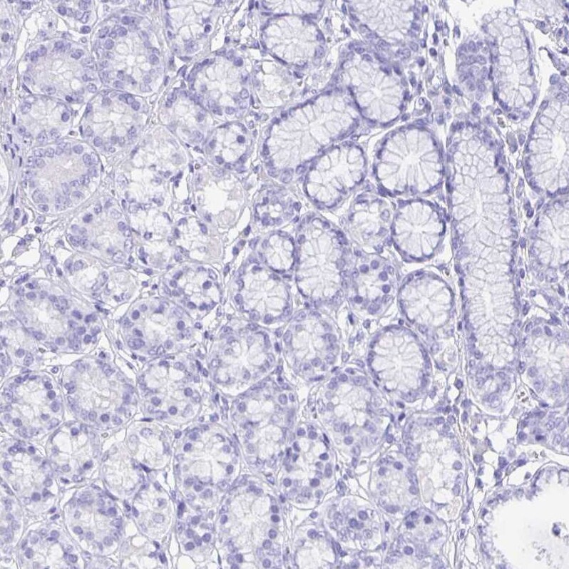 Guanylin Antibody - BSA Free Immunohistochemistry-Paraffin: Guanylin Antibody - BSA Free [NBP1-89724]