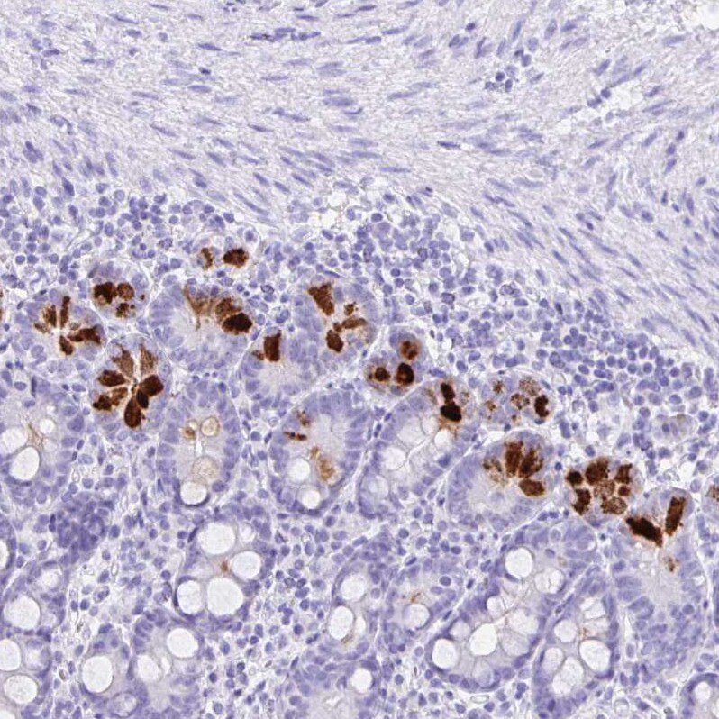 Guanylin Antibody - BSA Free Immunohistochemistry-Paraffin: Guanylin Antibody - BSA Free [NBP1-89724]