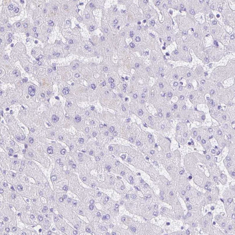 Guanylin Antibody - BSA Free Immunohistochemistry-Paraffin: Guanylin Antibody - BSA Free [NBP1-89724]