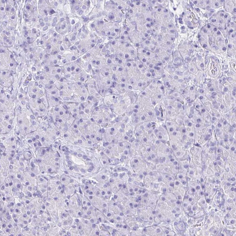 Guanylin Antibody - BSA Free Immunohistochemistry-Paraffin: Guanylin Antibody - BSA Free [NBP1-89724]