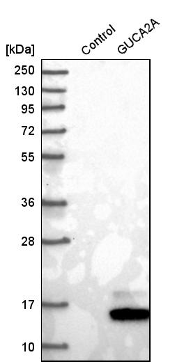 Guanylin Antibody - BSA Free Western Blot: Guanylin Antibody - BSA Free [NBP1-89724]