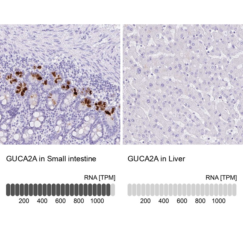 Guanylin Antibody - BSA Free Immunohistochemistry-Paraffin: Guanylin Antibody - BSA Free [NBP1-89724]