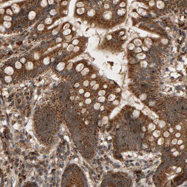 Glutathione S Transferase kappa 1 Antibody - BSA Free Immunohistochemistry-Paraffin: Glutathione S Transferase kappa 1 Antibody - BSA Free [NBP1-89726]
