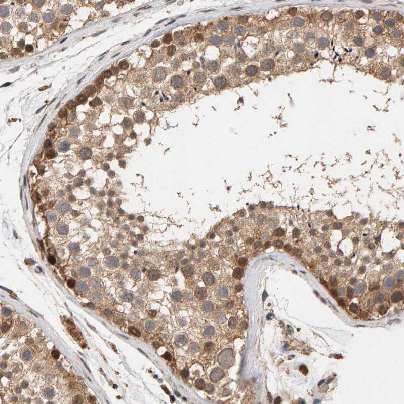 Glutathione S Transferase kappa 1 Antibody - BSA Free Immunohistochemistry-Paraffin: Glutathione S Transferase kappa 1 Antibody - BSA Free [NBP1-89726]