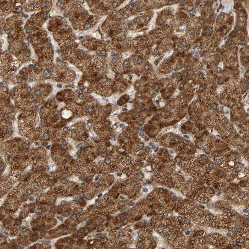 Glutathione S Transferase kappa 1 Antibody - BSA Free Immunohistochemistry-Paraffin: Glutathione S Transferase kappa 1 Antibody - BSA Free [NBP1-89726]