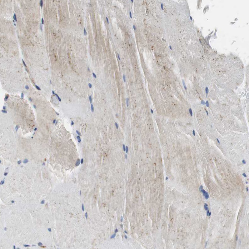 Glutathione S Transferase kappa 1 Antibody - BSA Free Immunohistochemistry-Paraffin: Glutathione S Transferase kappa 1 Antibody - BSA Free [NBP1-89727]