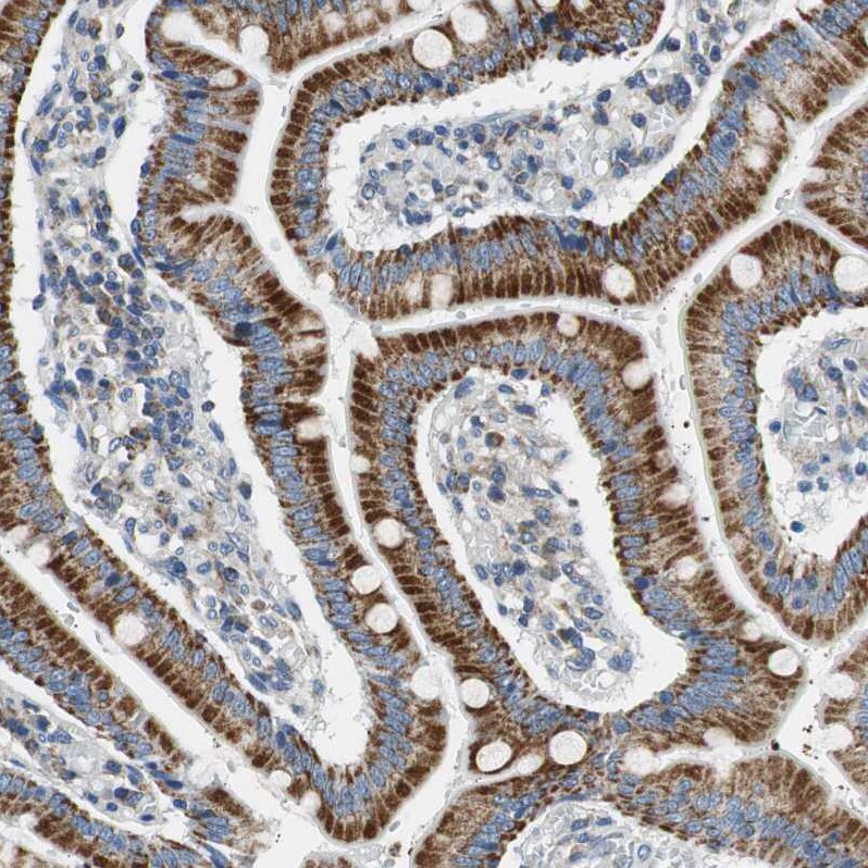 Glutathione S Transferase kappa 1 Antibody - BSA Free Immunohistochemistry-Paraffin: Glutathione S Transferase kappa 1 Antibody - BSA Free [NBP1-89727]