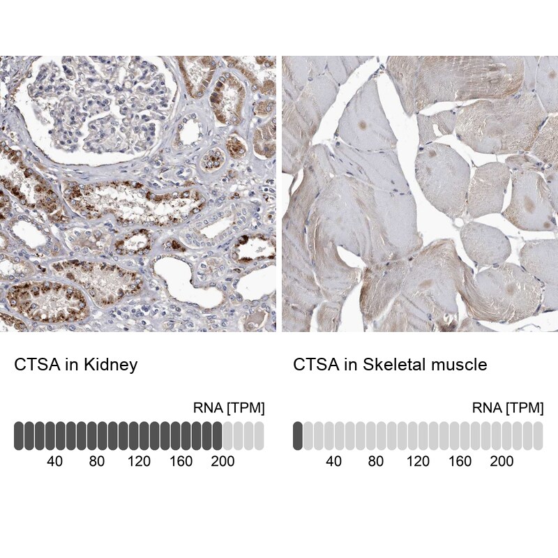 Cathepsin A/Lysosomal Carboxypeptidase A Antibody - BSA Free Immunohistochemistry-Paraffin: Cathepsin A/Lysosomal Carboxypeptidase A Antibody [NBP1-89728]