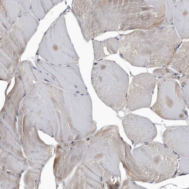Cathepsin A/Lysosomal Carboxypeptidase A Antibody - BSA Free Immunohistochemistry-Paraffin: Cathepsin A/Lysosomal Carboxypeptidase A Antibody [NBP1-89728]