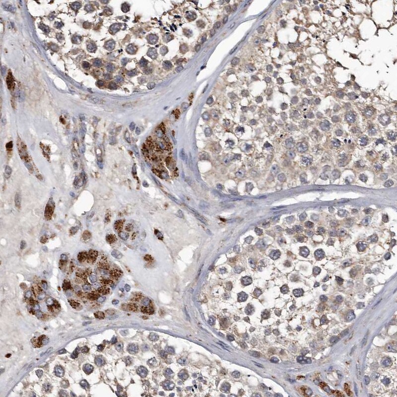 Cathepsin A/Lysosomal Carboxypeptidase A Antibody - BSA Free Immunohistochemistry-Paraffin: Cathepsin A/Lysosomal Carboxypeptidase A Antibody [NBP1-89728]