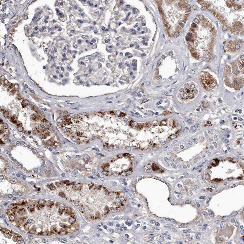 Cathepsin A/Lysosomal Carboxypeptidase A Antibody - BSA Free Immunohistochemistry-Paraffin: Cathepsin A/Lysosomal Carboxypeptidase A Antibody [NBP1-89728]