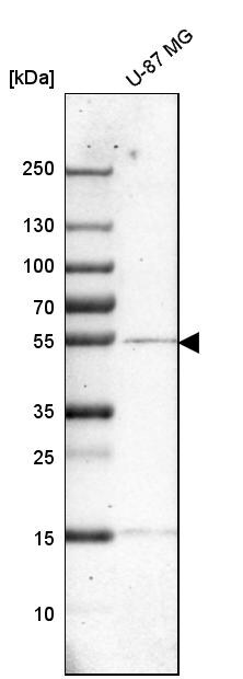Cathepsin A/Lysosomal Carboxypeptidase A Antibody - BSA Free Western Blot: Cathepsin A/Lysosomal Carboxypeptidase A Antibody - BSA Free [NBP1-89728]