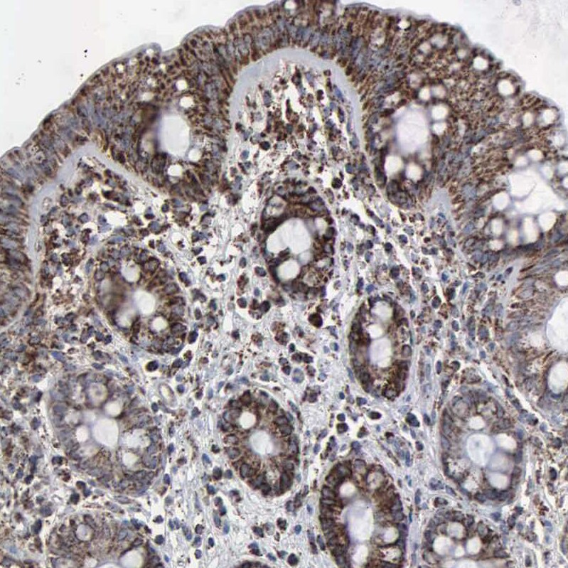 GRP75/HSPA9B/Mortalin Antibody - BSA Free Immunohistochemistry-Paraffin: GRP75/HSPA9B/Mortalin Antibody - BSA Free [NBP1-89729]