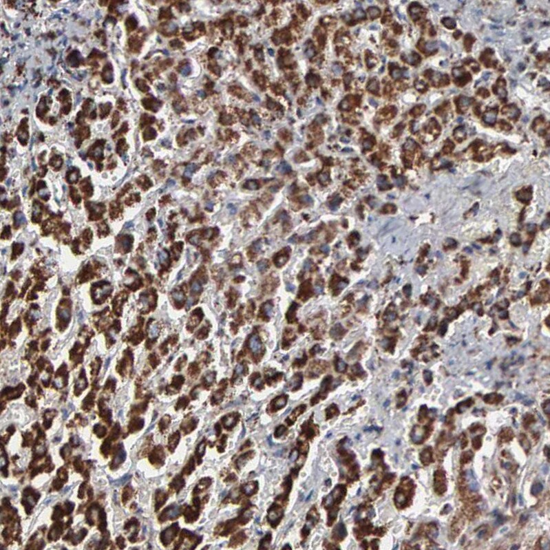 GRP75/HSPA9B/Mortalin Antibody - BSA Free Immunohistochemistry-Paraffin: GRP75/HSPA9B/Mortalin Antibody - BSA Free [NBP1-89729]