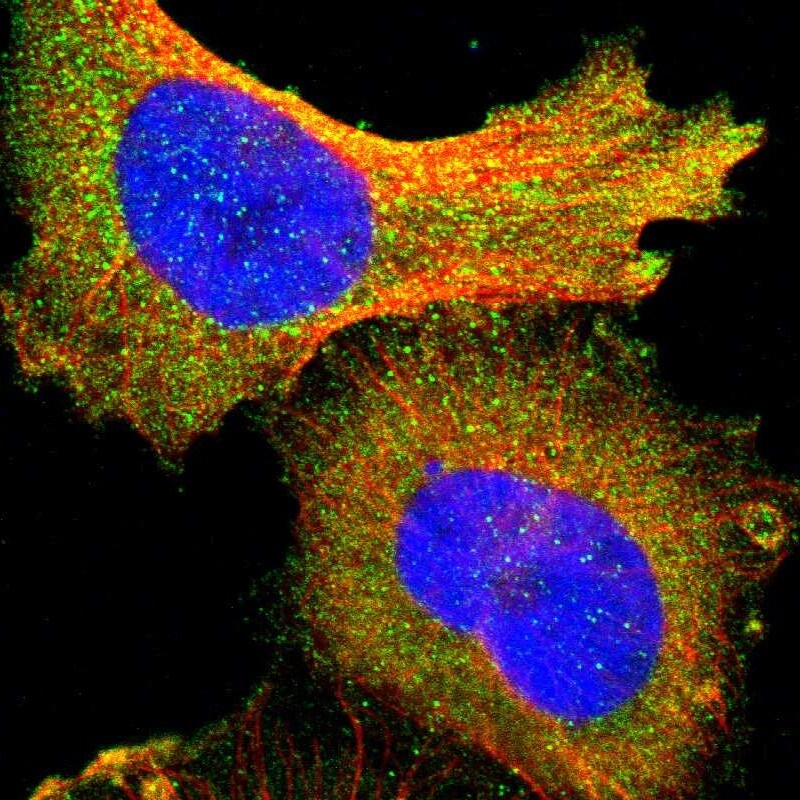 PI 3-Kinase p85 alpha Antibody - BSA Free Immunocytochemistry/ Immunofluorescence: PI 3-Kinase p85 alpha Antibody [NBP1-89731]