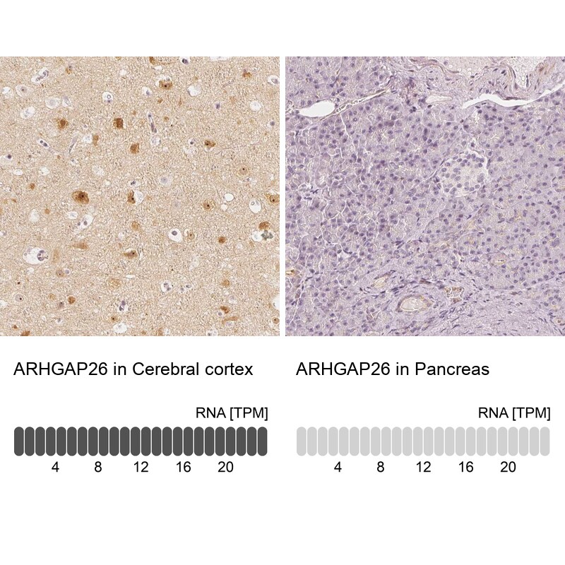 GRAF Antibody - BSA Free Immunohistochemistry-Paraffin: GRAF Antibody - BSA Free [NBP1-89732]