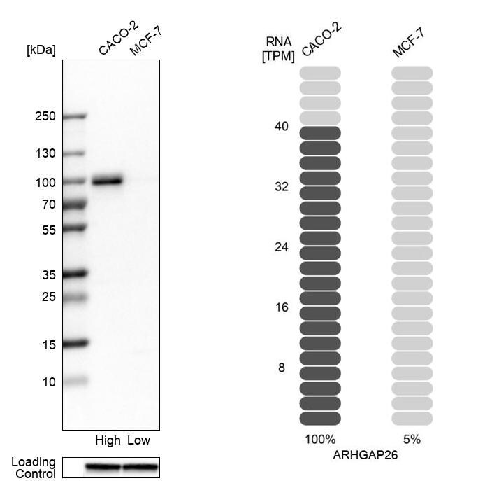GRAF Antibody - BSA Free Western Blot: GRAF Antibody - BSA Free [NBP1-89732]