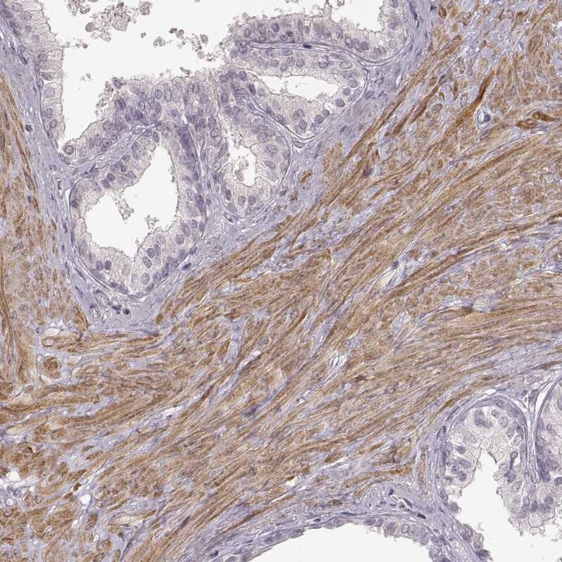 GPR10 Antibody - BSA Free Immunohistochemistry-Paraffin: GPR10 Antibody - BSA Free [NBP1-89741]