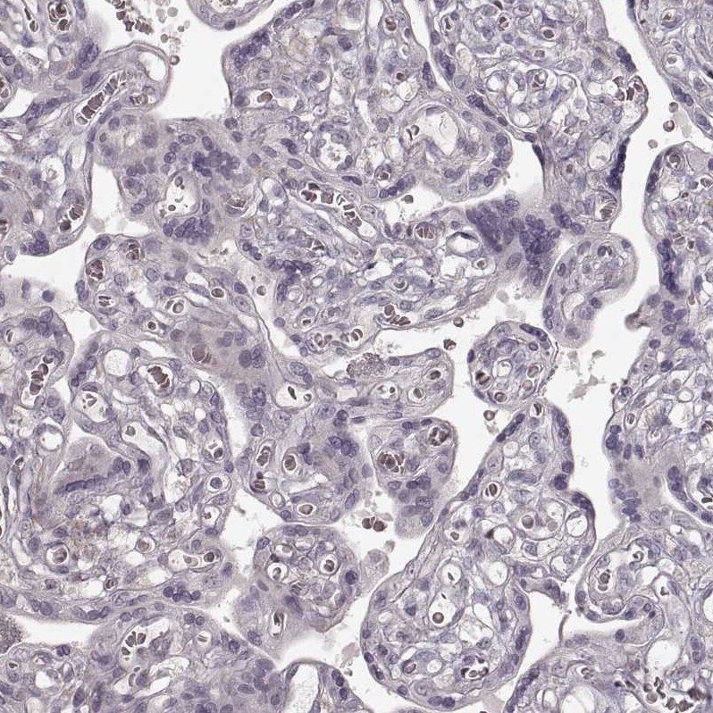 GPR10 Antibody - BSA Free Immunohistochemistry-Paraffin: GPR10 Antibody - BSA Free [NBP1-89741]