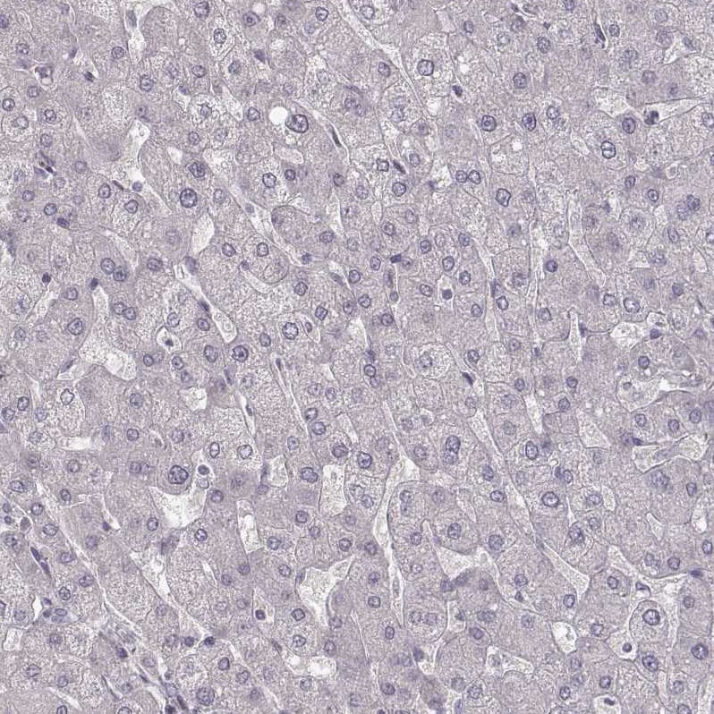 GPR10 Antibody - BSA Free Immunohistochemistry-Paraffin: GPR10 Antibody - BSA Free [NBP1-89741]