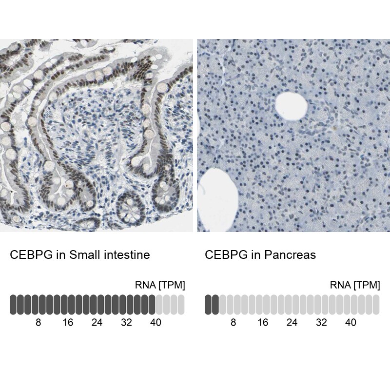 CEBP gamma Antibody - BSA Free Immunohistochemistry-Paraffin: CEBP gamma Antibody [NBP1-89742]