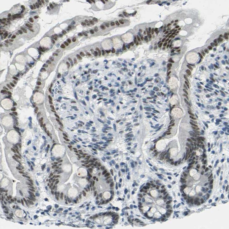 CEBP gamma Antibody - BSA Free Immunohistochemistry-Paraffin: CEBP gamma Antibody [NBP1-89742]