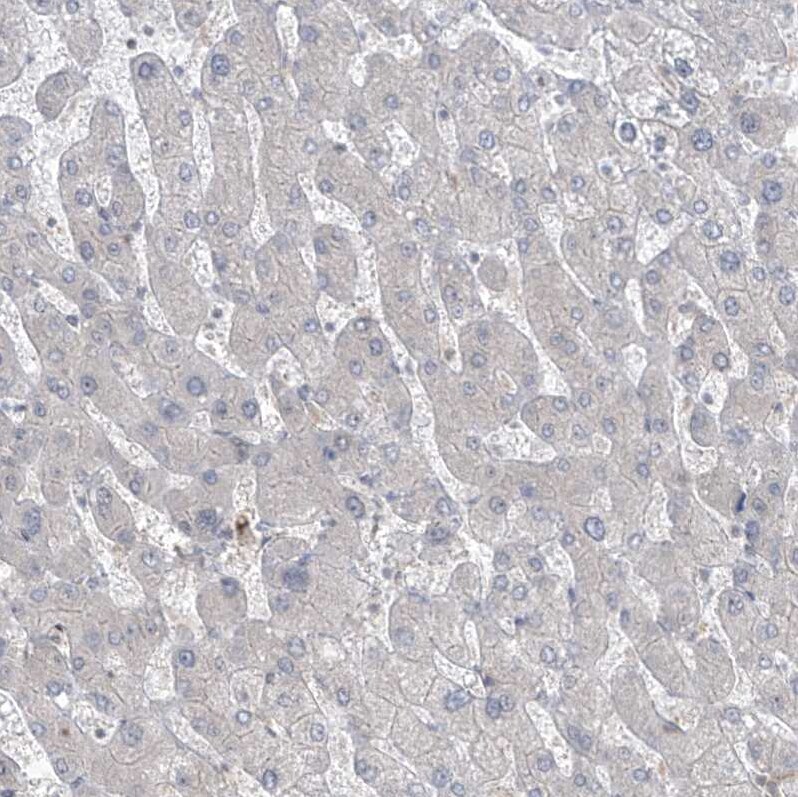 Phosphoribosyl Pyrophosphate Amidotransferase Antibody - BSA Free Immunohistochemistry-Paraffin: Phosphoribosyl Pyrophosphate Amidotransferase Antibody [NBP1-89744]