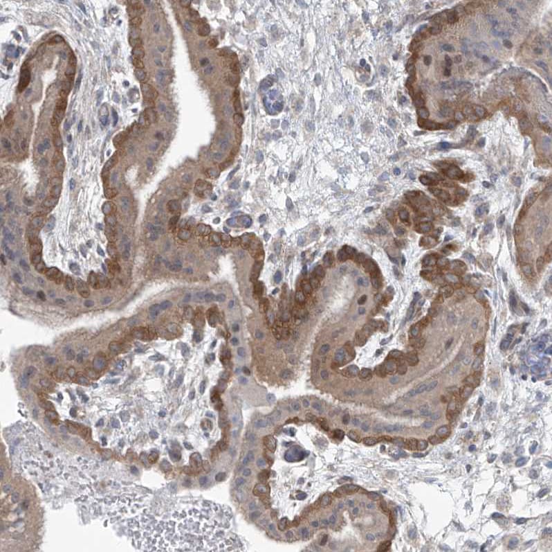 Phosphoribosyl Pyrophosphate Amidotransferase Antibody - BSA Free Immunohistochemistry-Paraffin: Phosphoribosyl Pyrophosphate Amidotransferase Antibody [NBP1-89744]