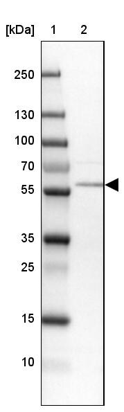Phosphoribosyl Pyrophosphate Amidotransferase Antibody - BSA Free Western Blot: Phosphoribosyl Pyrophosphate Amidotransferase Antibody - BSA Free [NBP1-89744]