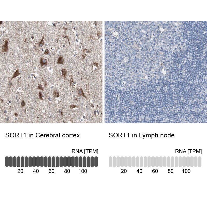 Sortilin Antibody - BSA Free Immunohistochemistry-Paraffin: Sortilin Antibody - BSA Free [NBP1-89745]