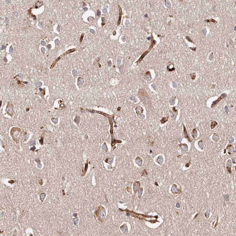 GTP-binding protein 1 Antibody - BSA Free Immunohistochemistry-Paraffin: GTP-binding protein 1 Antibody - BSA Free [NBP1-89746]